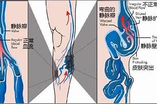 静脉